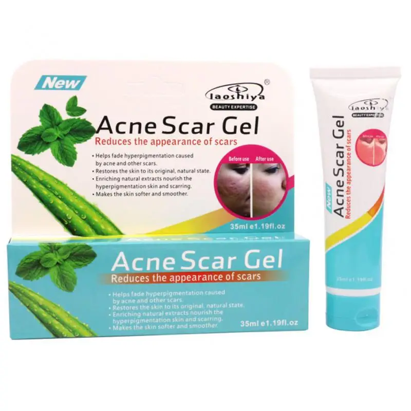 Authentic Acne Treatment Cream Anti Acnes Cream Scar Removal Cleansing Gel Pimple Shrink Pore Fade Acne Mark For Face Skin Care