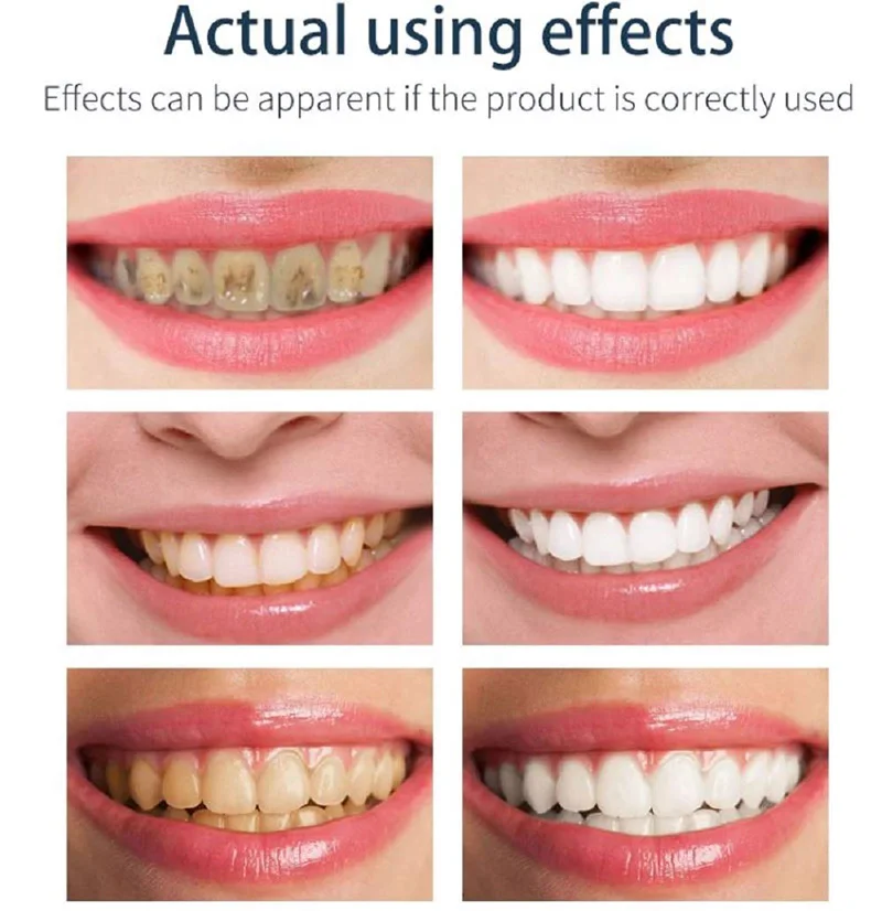 Мятный лимонный аромат мусс зубная паста удаляет зубные пятна налет для очистки