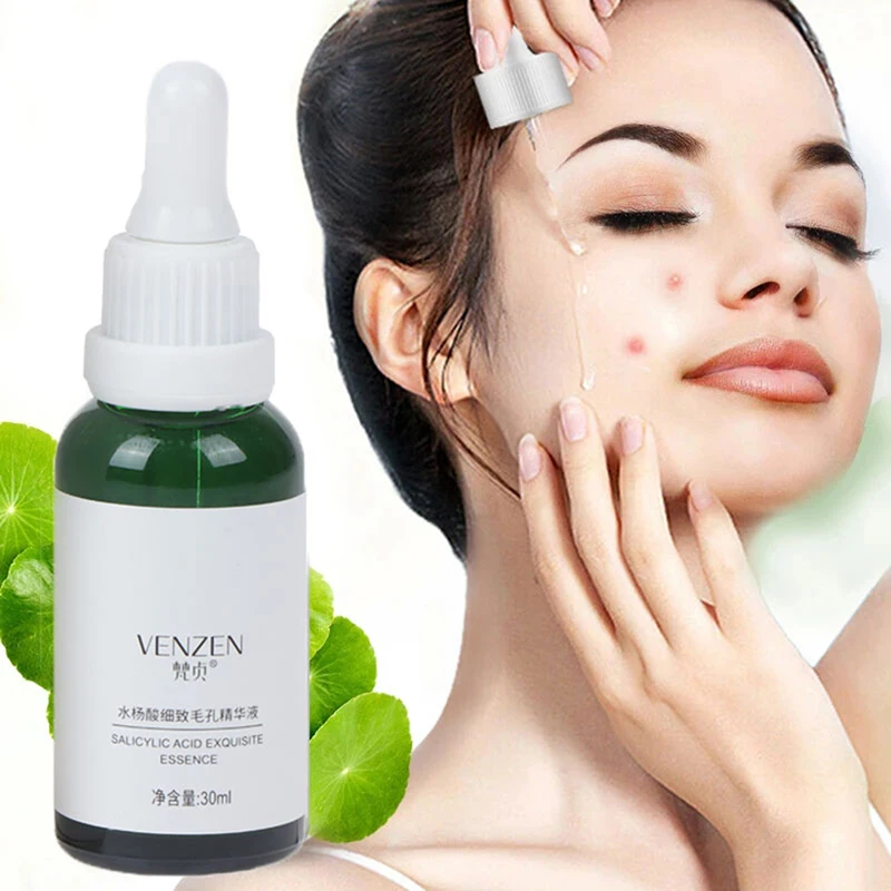 

30ml Aloe Salicylic Acid Acne Treatment Serum Oil Control Shrink Pores Face Essence Hyaluronic Acid Moisturizing Brighten Skin