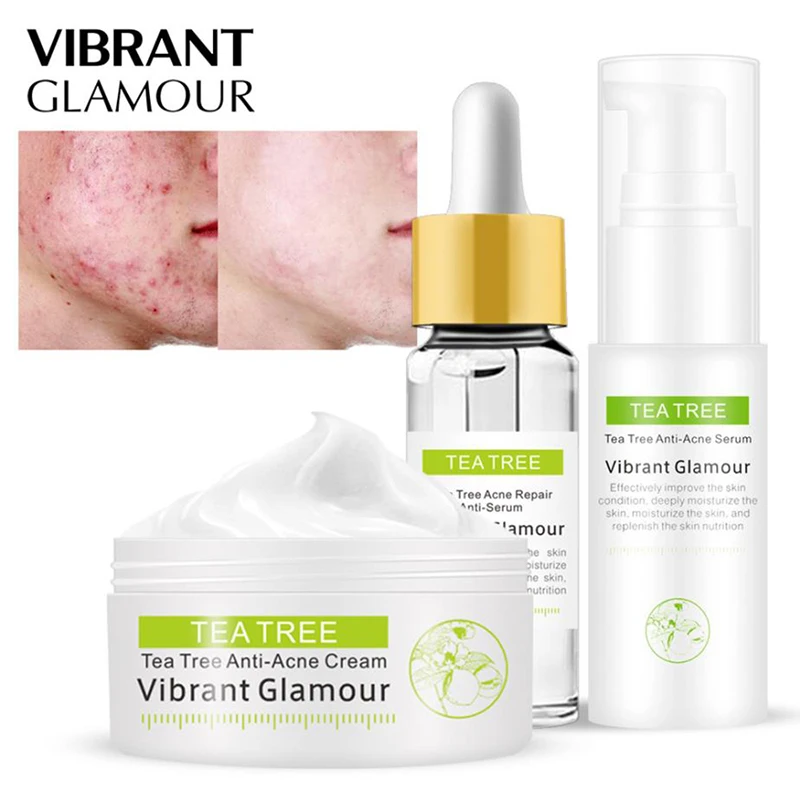 

Effective whitening cream, can remove acne essence, treat bleaching, acne spots, control sebum,