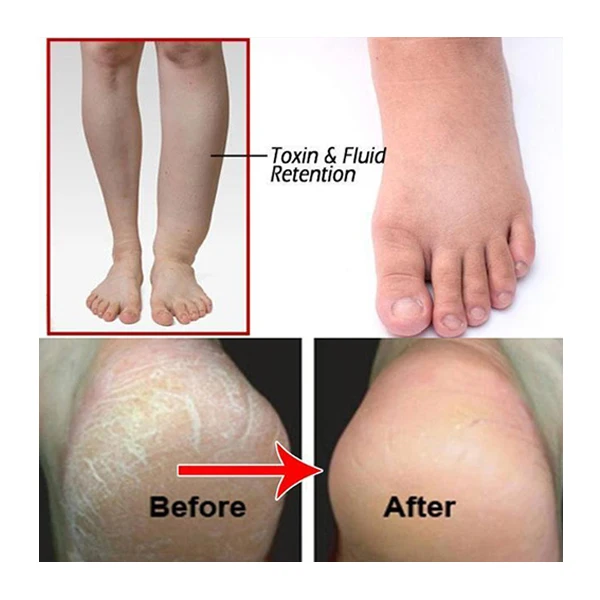 Новый имбирь пропитанный стопой шипучие таблетки ванна для ног порошок AI YE