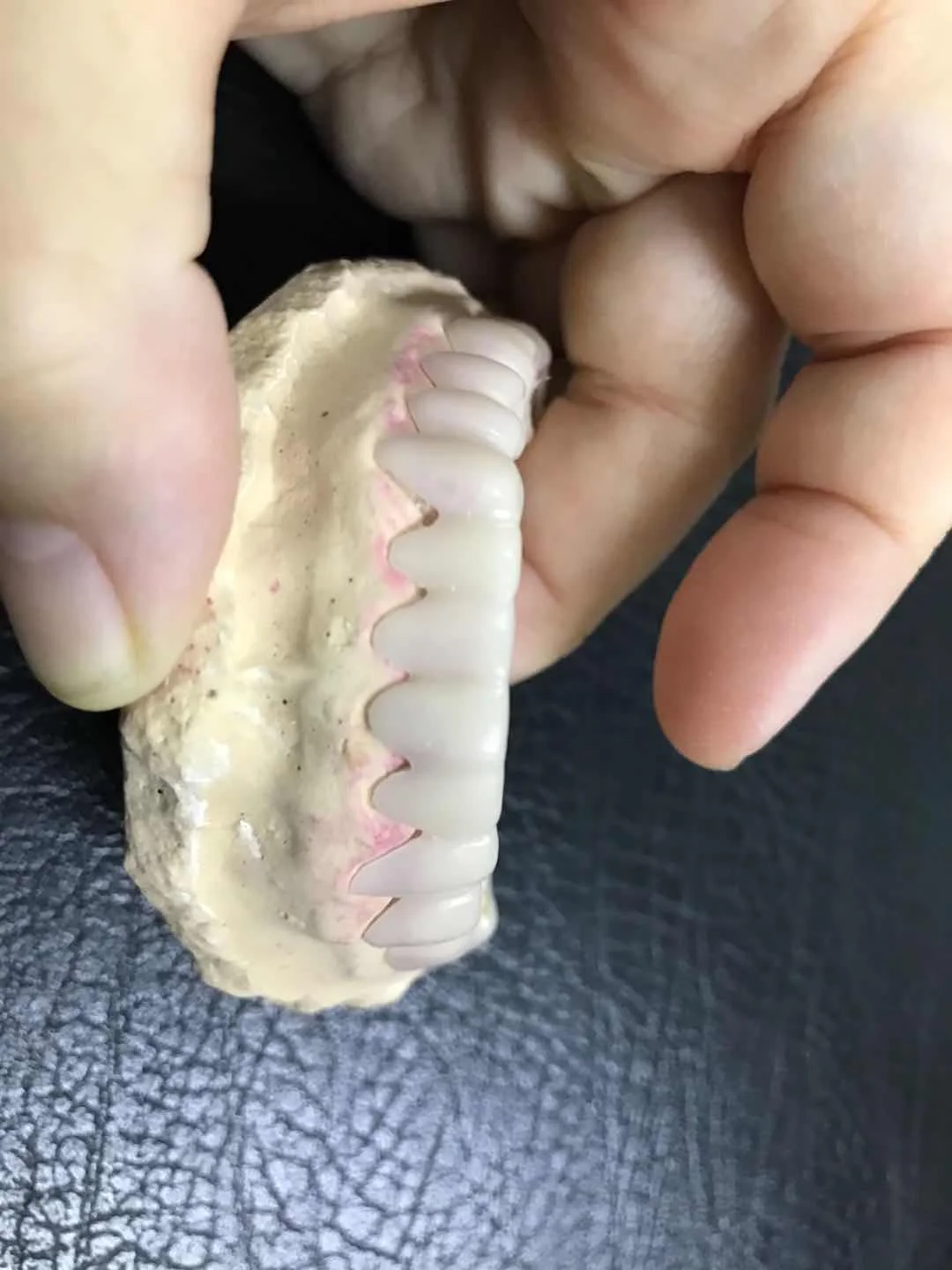 2 шт./лот Acetal Гибкая ПММА для частичных протезов 98 14 мм snap smile A1/A0/B1/Чистая цветная