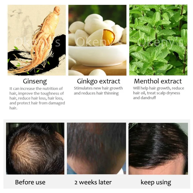 Hair Growth Essence Spray Growth Oil Preventing Baldness Anti Hair Loss Hair Care Nourishing Enhancing Hair Roots