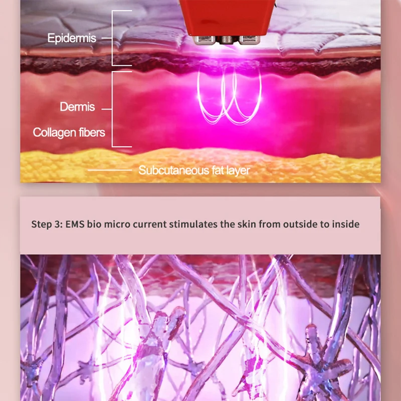 Koop Bb Look Microstroom Apparaat Gezicht Lifting Draai Rimpel Verwijdering Schoonheid Instrument Radio Frequentie Huid Aanscherping Massager