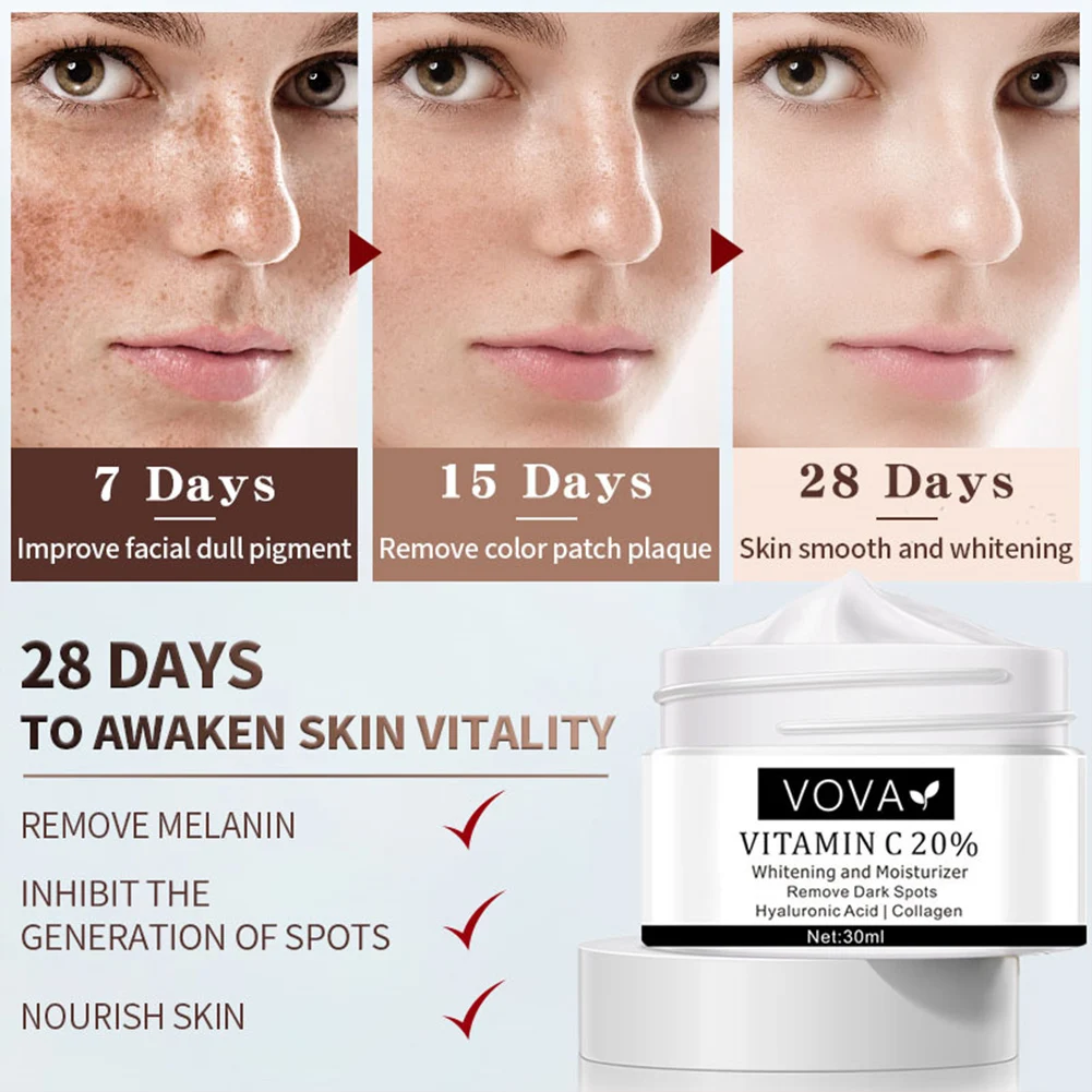 

VOVA Effective Whitening Freckle Cream Rich in Vitamin C for Removing Melasma Acne Dark Spots Pigmentation Moisturizing Gel