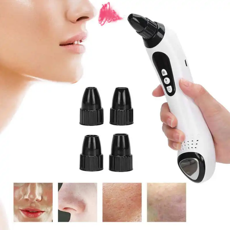 

Electric Blackhead Remover Machine Hot Cold Compress Acne Blackhead Removal Machine Face Care