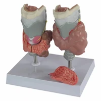 medical anatomical model of thyroid pathology larynx hyperthyroidism hypothyroidism specimen