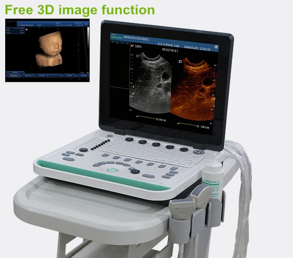 

15in Led human B/W 3D notebook ultrasound scanner machine PC based with C E