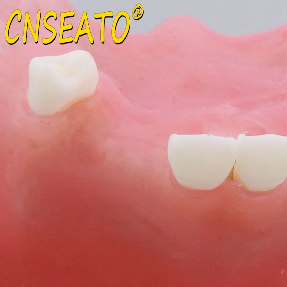 Стоматологическая модель зубов зубной тренажер для тренировки подъема кости в