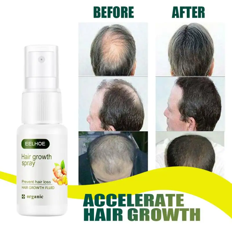 Имбирная Сыворотка для роста волос 20 мл против выпадения Alopecia жидкость
