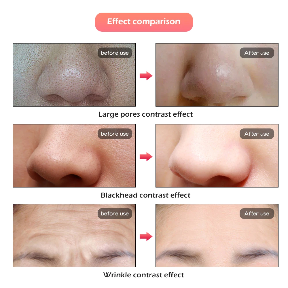 Deciniee 7 цветов Светодиодная маска для лица светодиодная Корейская фотонная