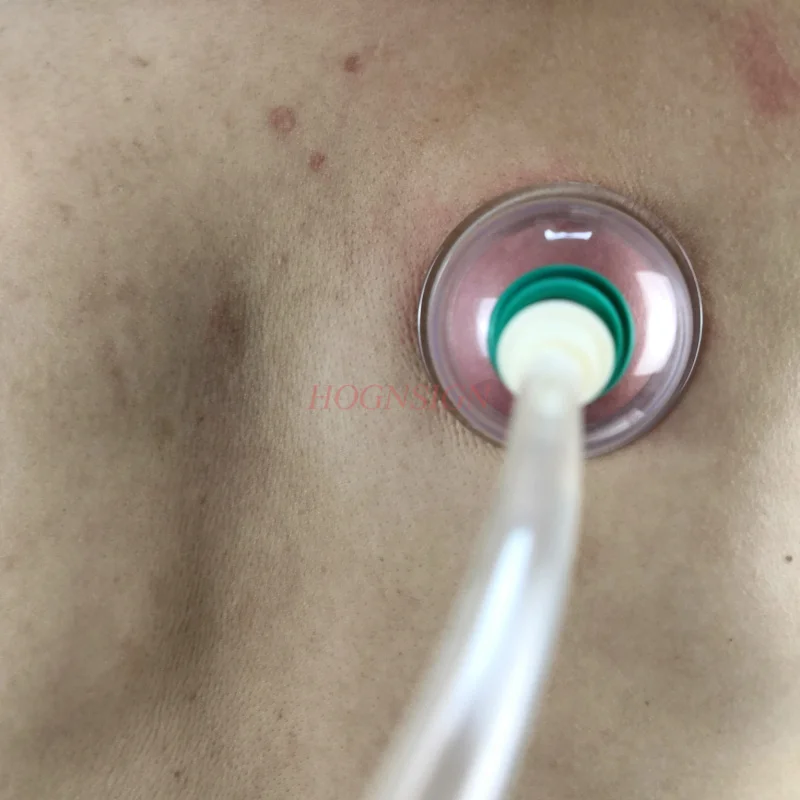 7 шт./компл. вакуумный всасывающий пистолет для Вентоса Terapia универсальный