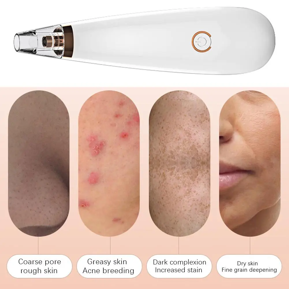 Удаление угрей вакуумный аппарат для очистки пор Электрический Нос лицо