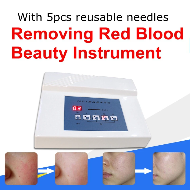 

Red Blood Vessel Spots Vascular Removal Beauty Equipment High Frequency Needle RF Spider Veins Removal Anti Redness Machine