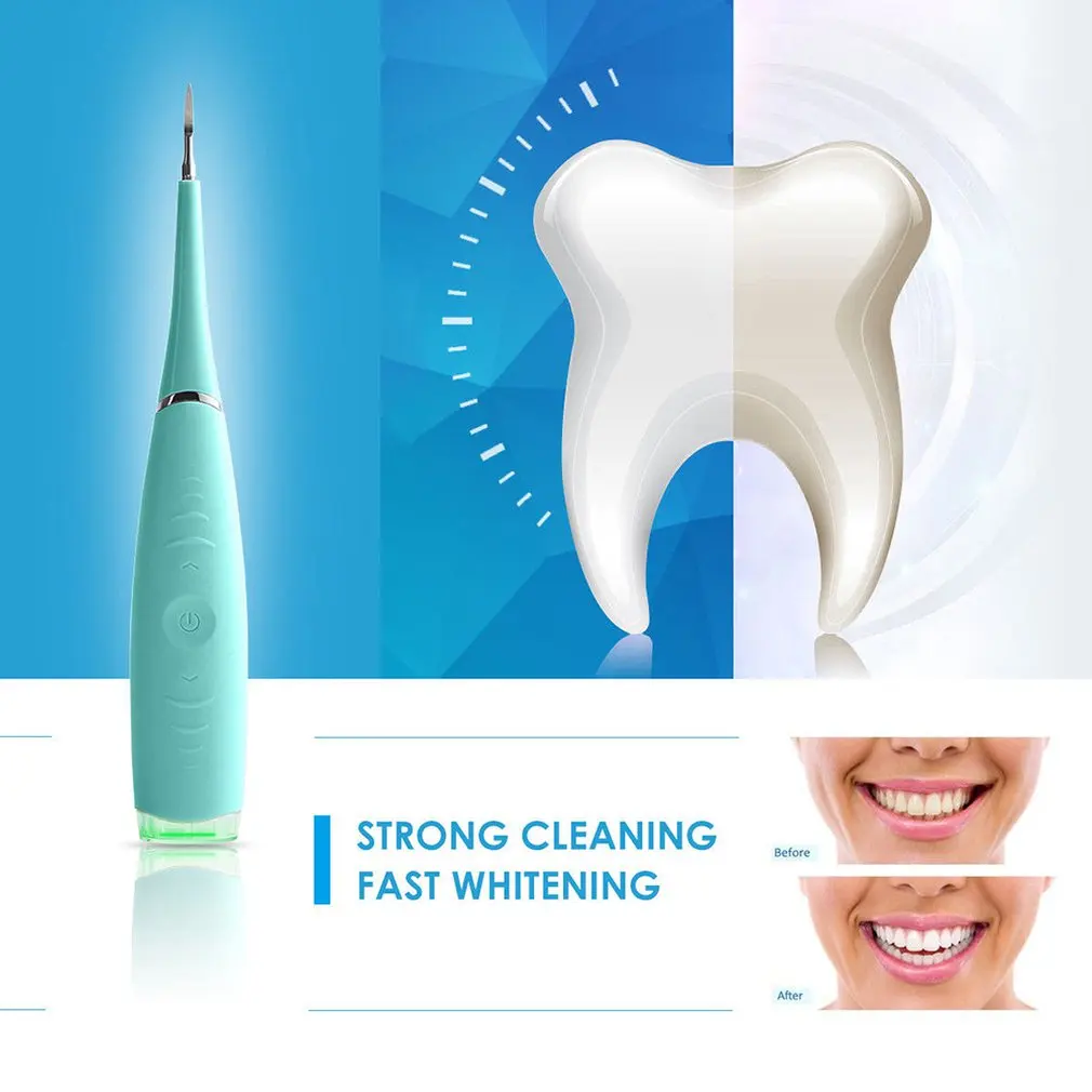

Portable Electric Sonic Dental Scaler Tooth Calculus Remover Tooth Stains Tartar Tool Dentist Whiten Teeth Health Hygiene white