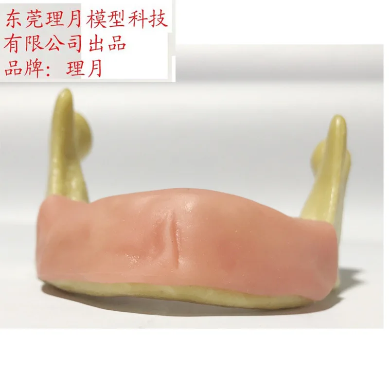 Бионические ЧЕЛЮСТИ КОСТНОЙ десны зубы полости рта реставрация имплантата