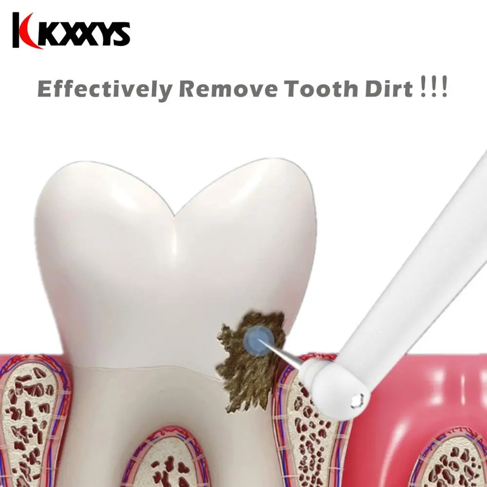 Электрический ультразвуковой ластик для зубов удалитель зубного налета