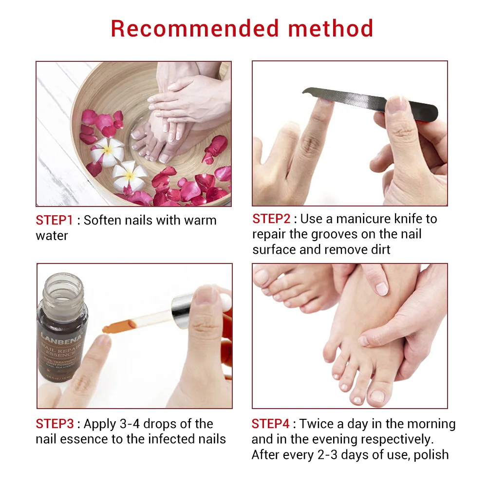 

LANBENA New Nail Liquid-Treatment File Nail Care Fungus Toe Anti Remove Nail Onychomycosis Essence Fungal Cuticle Removal-Gel