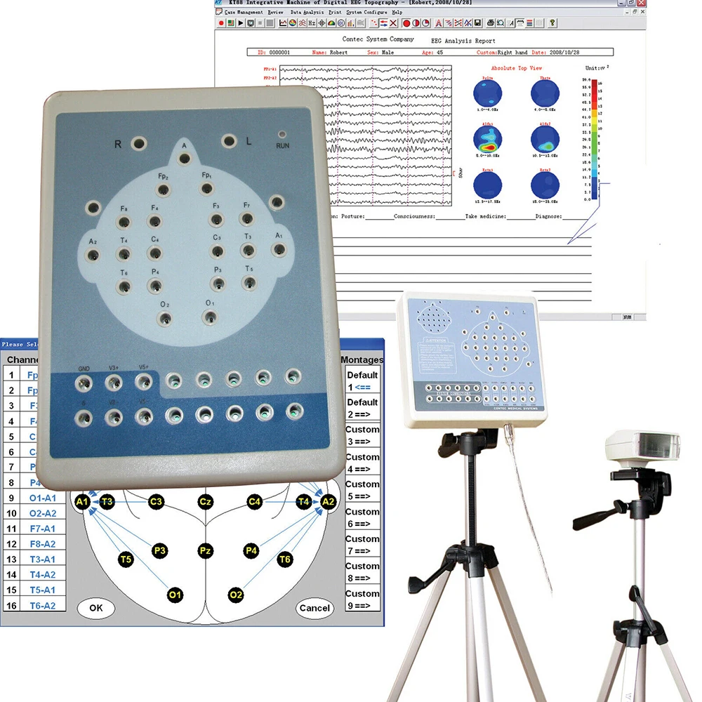 KT88-1016 Digital Brain Electric Activity Mapping System 16 Channel EEG Machine Electroencefalogram USB Software | Красота и здоровье