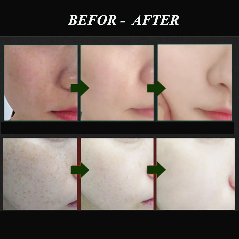 Капсулы для детоксикации лица салона красоты 100 шт. экспорт свинца ртути меланина