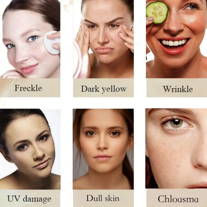 1 шт. отбеливающий крем для лица с экстрактом арбутина|Отбеливание зубов| |