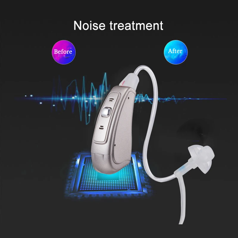 

Amplifier In The Ear Hearing Aid Digital Chip Sound Enhancer With A312 Battery Built-in Tinnitus Masker Gift For Elderly MY-20