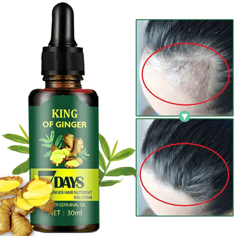 

30ml 7 Days Ginger Hair Growth Essence Oil Prevent Hair Loss Hair Spray Thinning Hair for Men&women