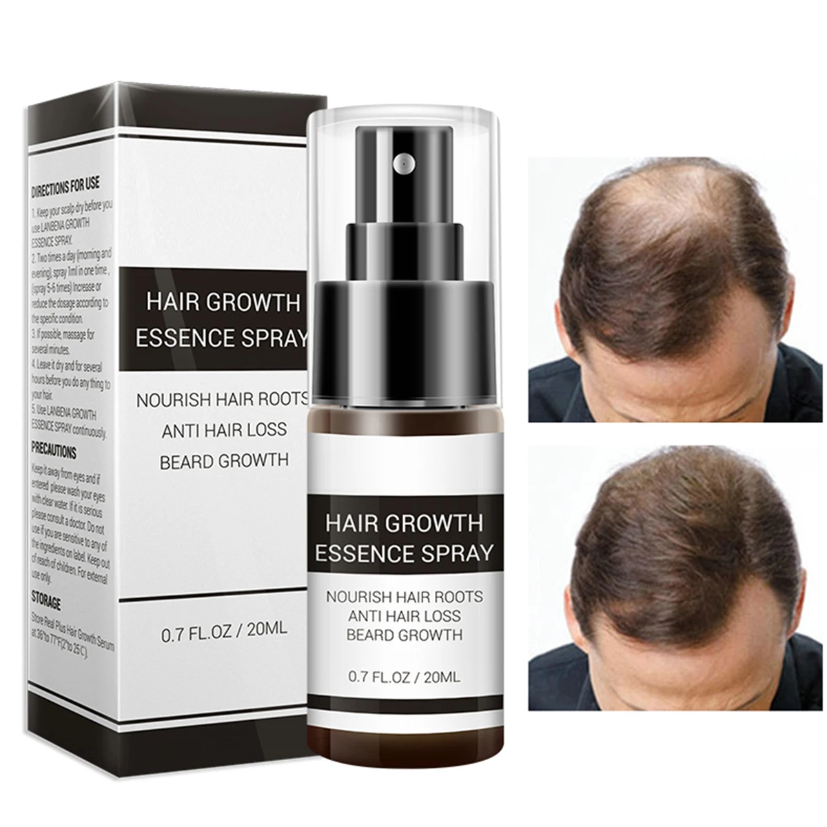 Эссенция для роста волос 20 мл спрей против выпадения лечение питание жидкий Уход