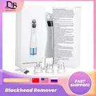 Очиститель черных точек от черных точек на носу, вакуумный очиститель пор