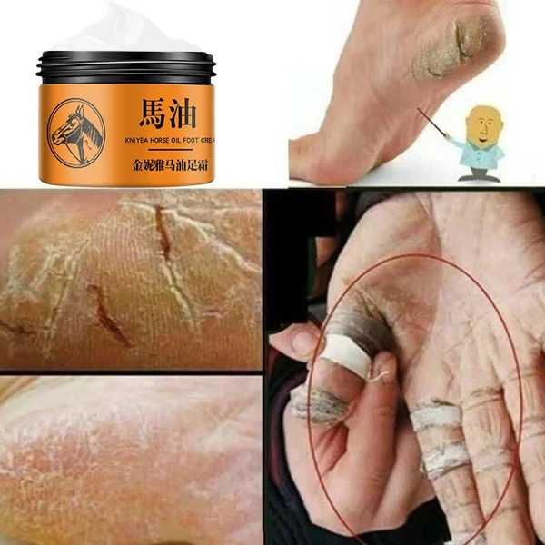 

Horse Oil Hand And Foot Repair Cream Skin Moisturizing Foot Skin Care