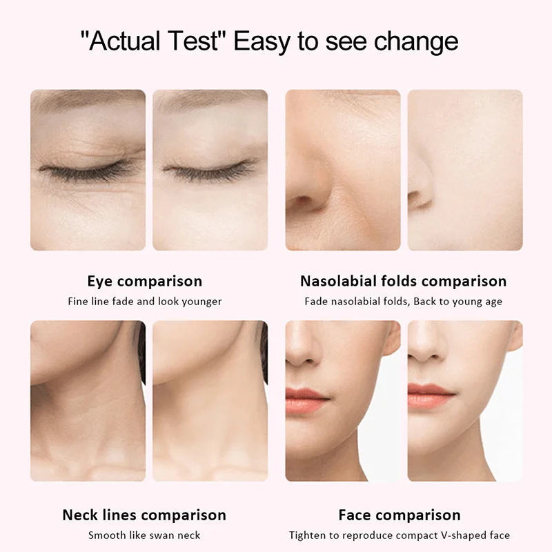 Массажер для лица укрепляющий прибор устройство удаления морщин и ухода за кожей