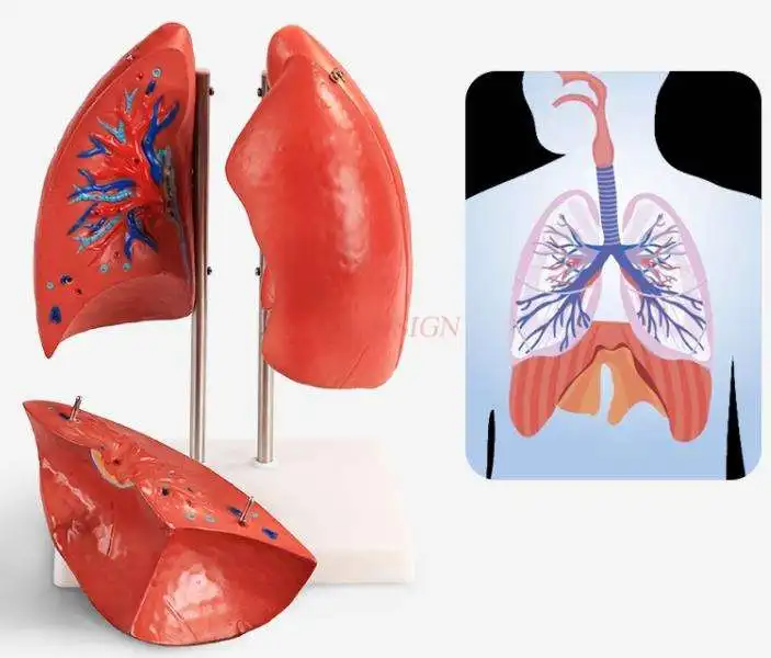 Легких модель медицинского слуховые аппараты Легочное Дыхание легких