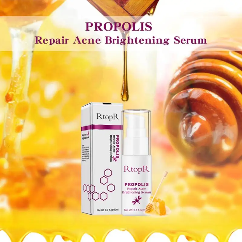 

RtopR Cleansing Acne Cream Acne Treatment Anti Acne Cream Oil Control Shrink Pores Acne Scar Remove Face Care Korean cosmetics