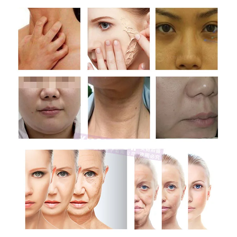 2 в 1 аппараты для охлаждения лица