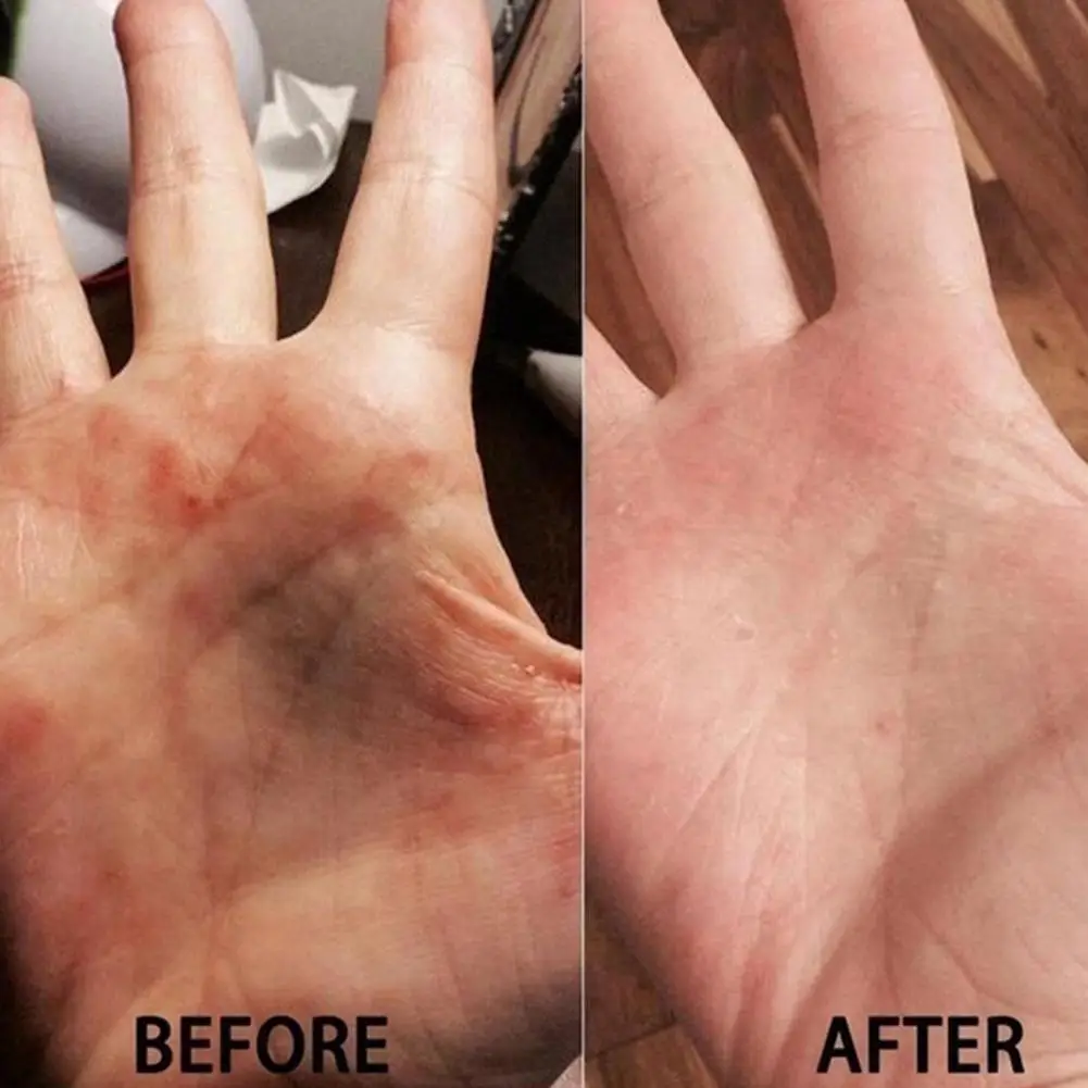 Женский Профессиональный питательный отбеливающий крем для удаления пятен на