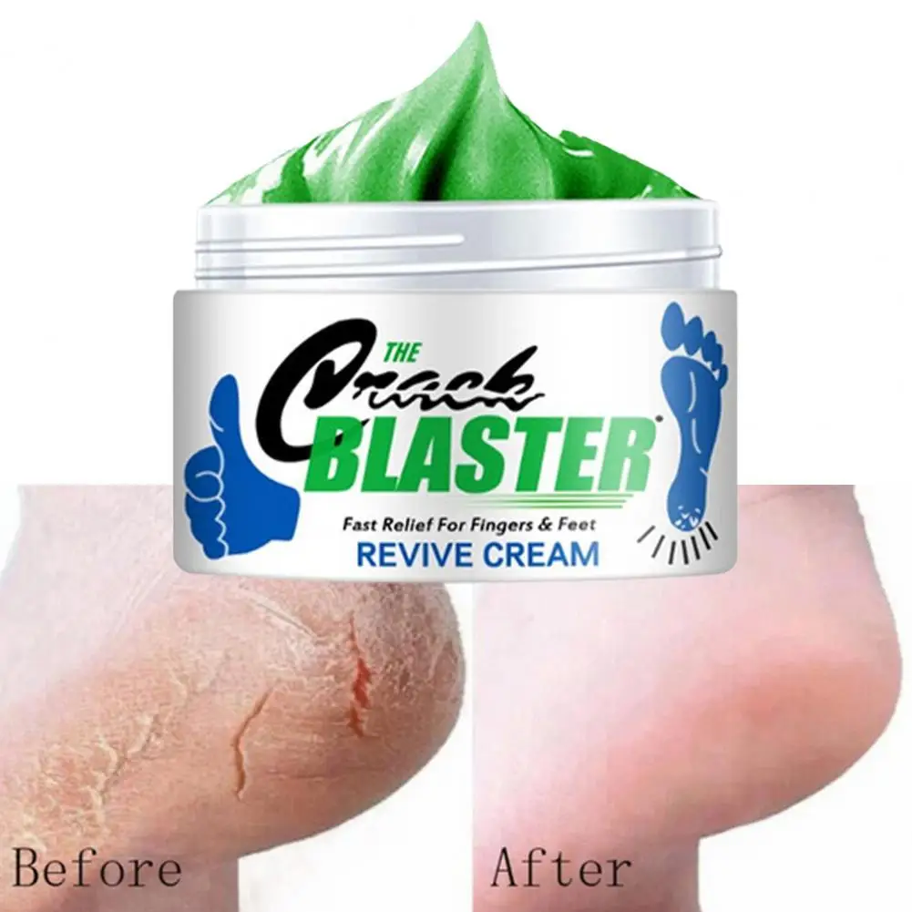 

15g/ 30g/ 50g Cracked Heel Repair Cream Deeply Moisturize Soften Skin Dry Feet Treatment Rough Dry Feet Repair Cream for Repair