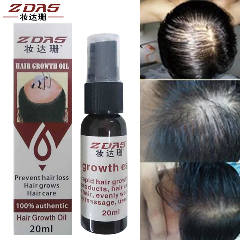 Эффективная эссенция для роста волос масло филировка продукты против выпадения