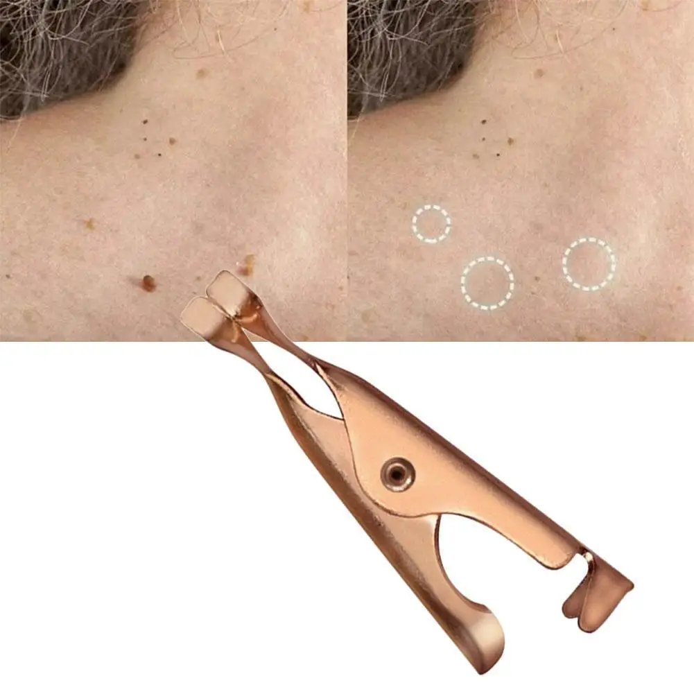 

1 Pcs Skin Tags Remover Small Clip For Wart Remover Copper Clip Tags Out Skin Wart Tags Tattoo Clamp Beauty Makeup Healths Tools