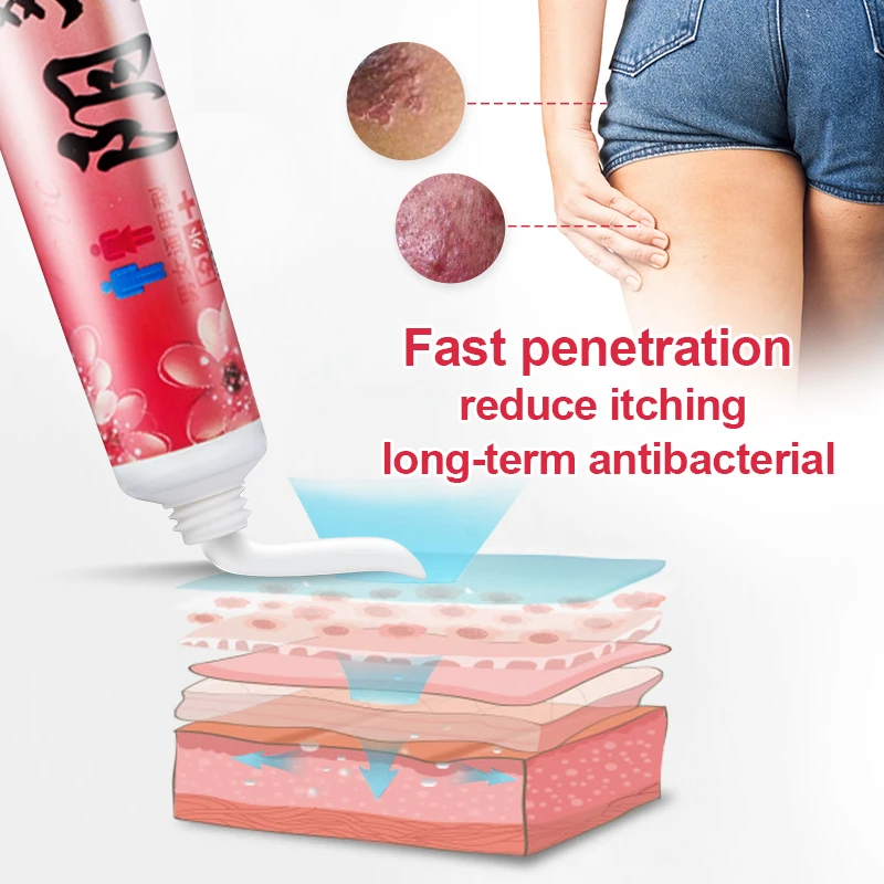 15 г травяная Антибактериальная мазь для удаления запаха зуда дерматита