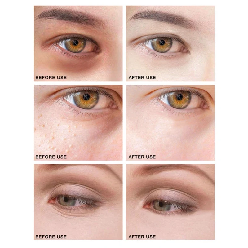 24K Golden Eye Cream Remove Dark Circles Pouches Fine Lines Anti-Aging Lower Eyelid Firming Gel Eyes Skin Care Product | Красота и