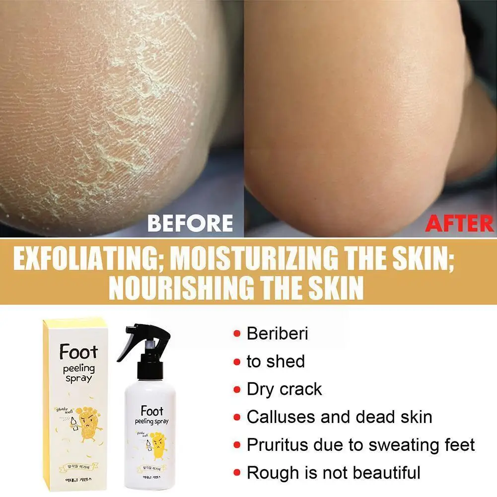 

Foot Peeling Spray Natural Orange Essence Dead Skin Foot Whiten Cosmetic Moisturizer Spray Remover Calluses Moisturizing Ca Q3m3