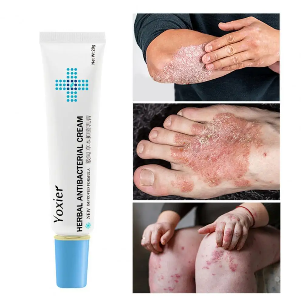 

20g Herbal Cream Anti-itch Effective Natural Extract Skin Rash Urticaria Desquamation Treatment Herbal Cream for Body
