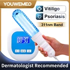 UVB 311нм Бытовая ультрафиолетовая лампа, инструмент для Vitiligo, фототерапия, лампа для лечения Vitiligo, лечение псориаза, фототерапия