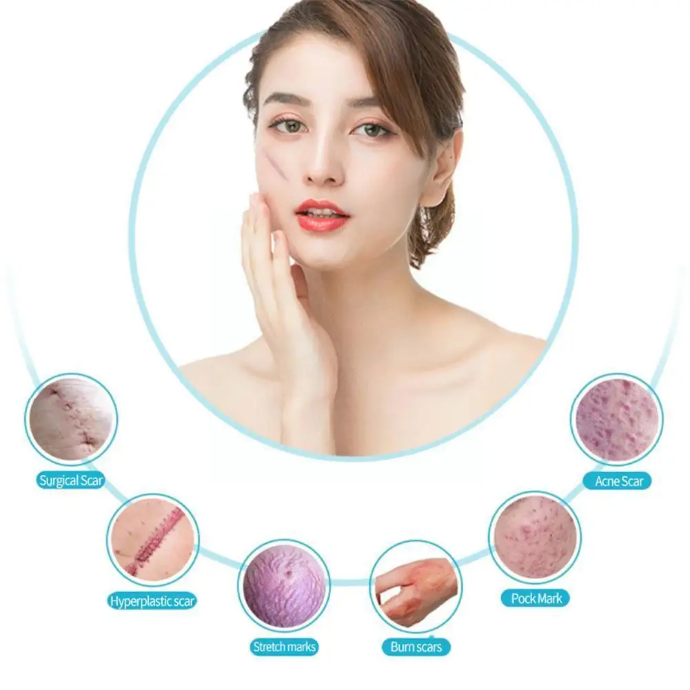 

10ml Repair Scar Face Serum Acne Whitening For Spots Fade Stretch Skin Serum Marks Treatment Care Acne Skin Scars Repair Es T4A4
