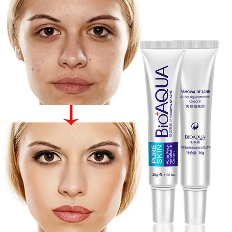 30g Acne Treatment Blackhead Remova Anti Acne Cream Oil Control Shrink Pores Acne Scar Remove Face Care Whitening