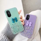 Чехол для OPPO Reno4 Z F Lite SE 2 Z 3 4G 4 Pro 5G 5 Pro Plus, милый мягкий чехол из ТПУ с бантом и звездами