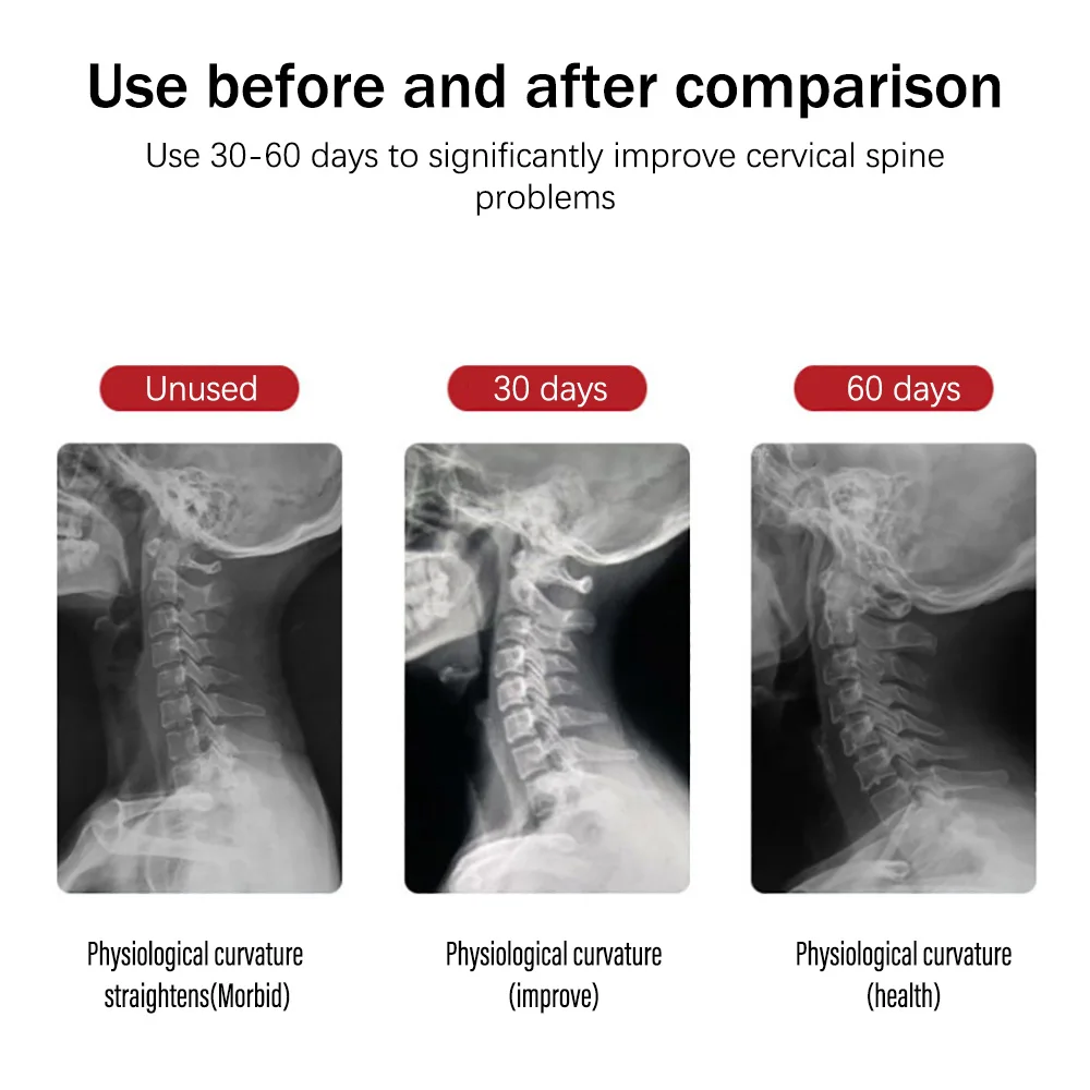 

Yongrow Inflatable Cervical Neck Traction Adjustable Neck Stretcher Collar Stretching Correction Therapy Neck Care Health Care