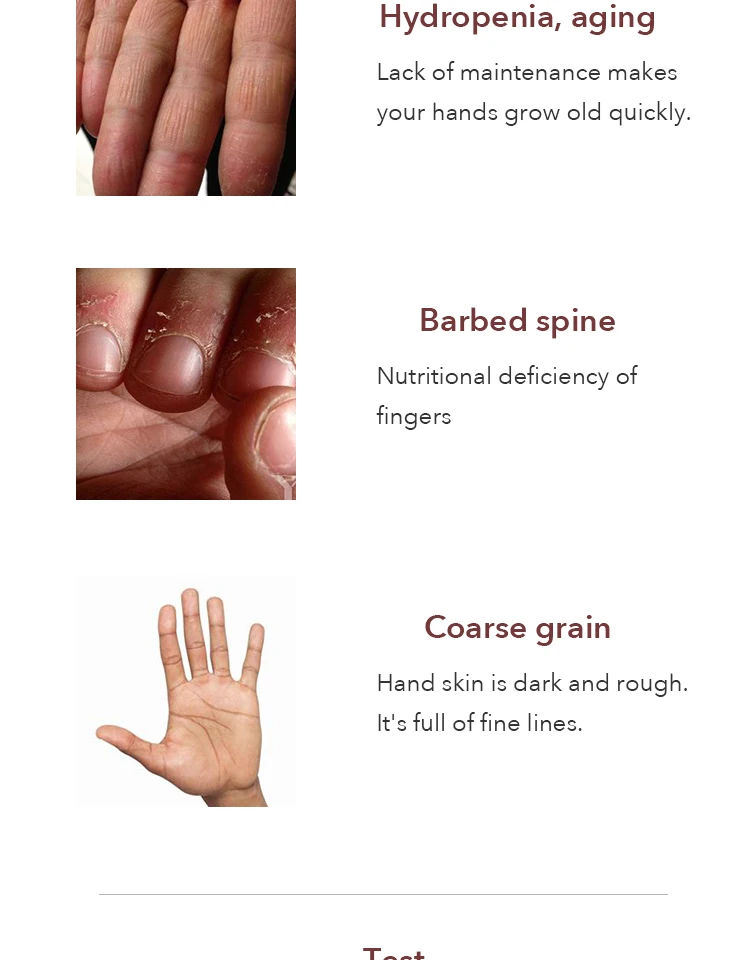 Отбеливающий крем для рук Goatmilk против сухости увлажняющий покрытия уход за