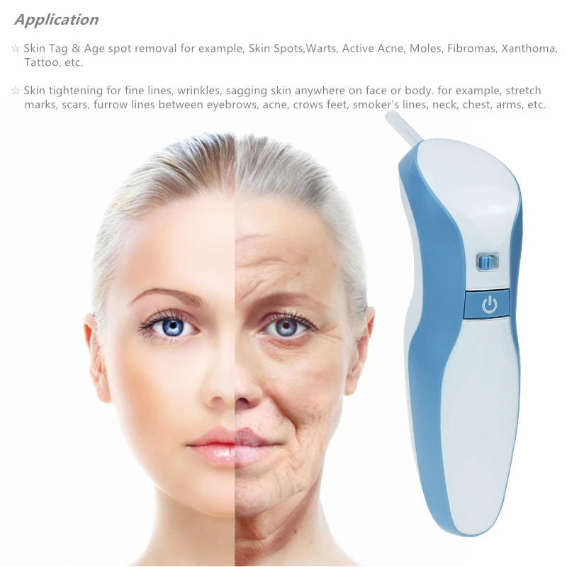 Профессиональная плазменная ручка для подтяжки век лазерная аппарат удаления