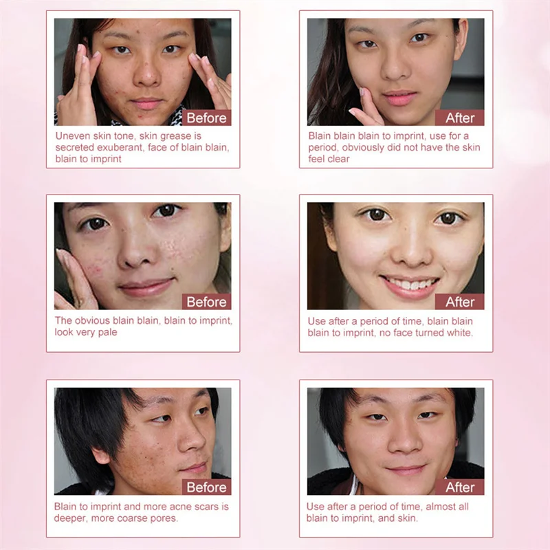 Крем-гель для ухода за кожей лица 15 г | Красота и здоровье